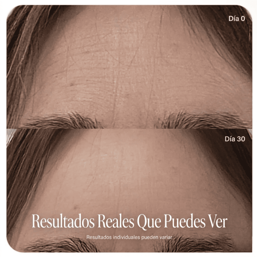 AURA - Máscara de belleza LED TERAPIA luz roja