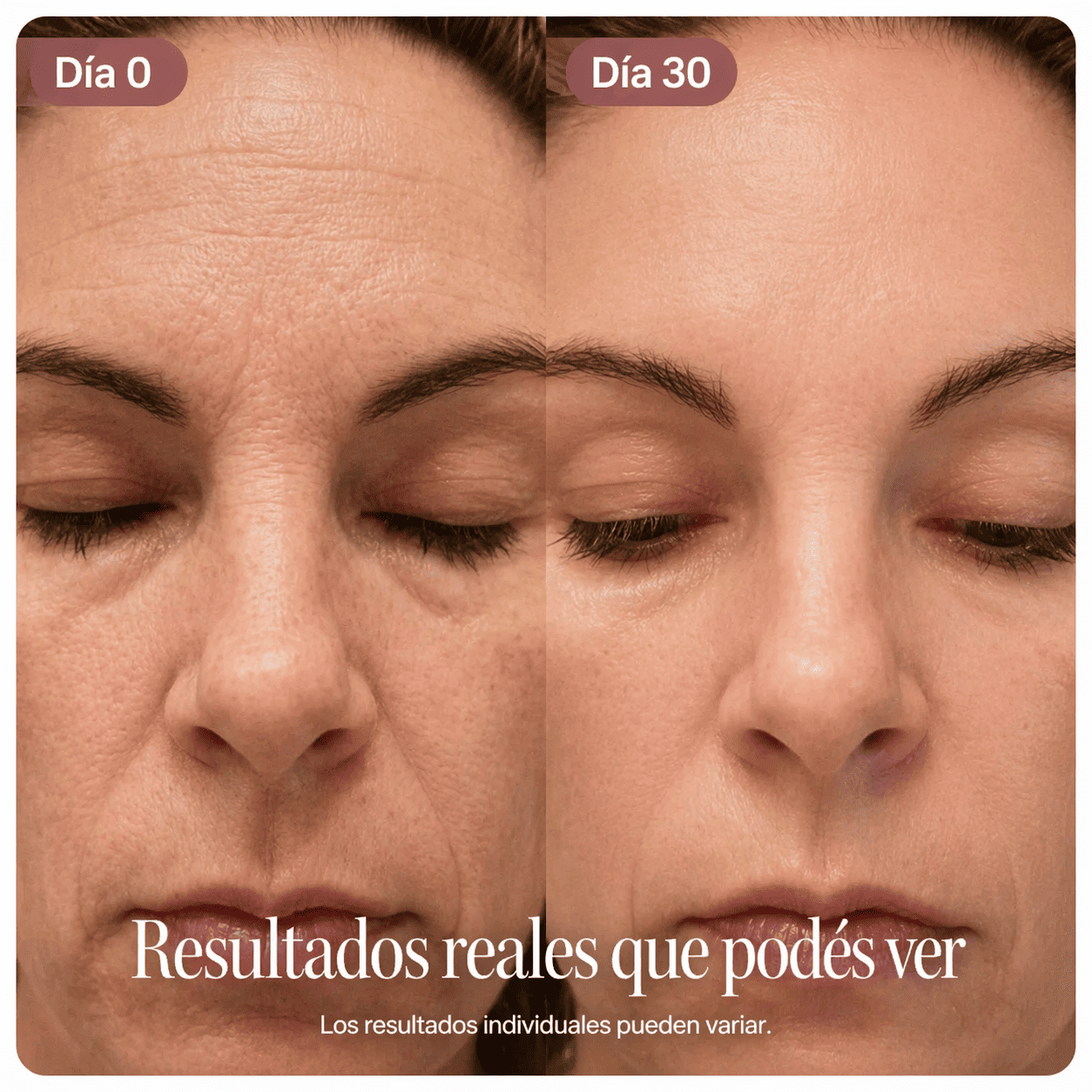 Antes